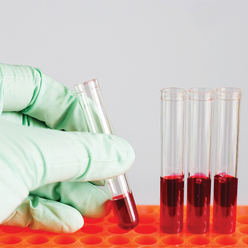 Allergen Response Assays