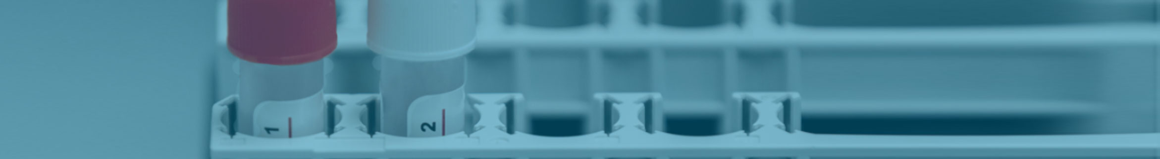 HbA1c Whole Blood Haematology Controls