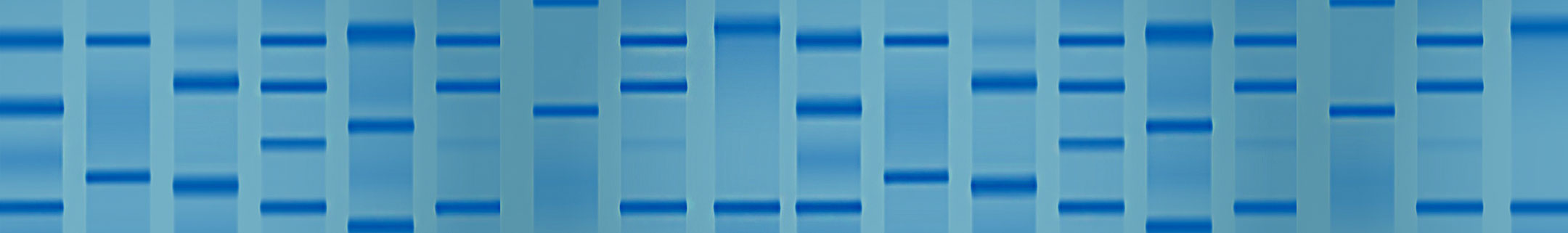 Buffers, Markers and Blotting Reagents