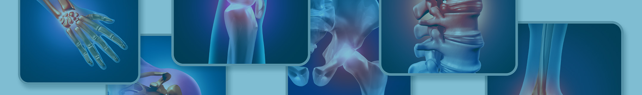 Rheumatoid inflammatory Disease Monitoring