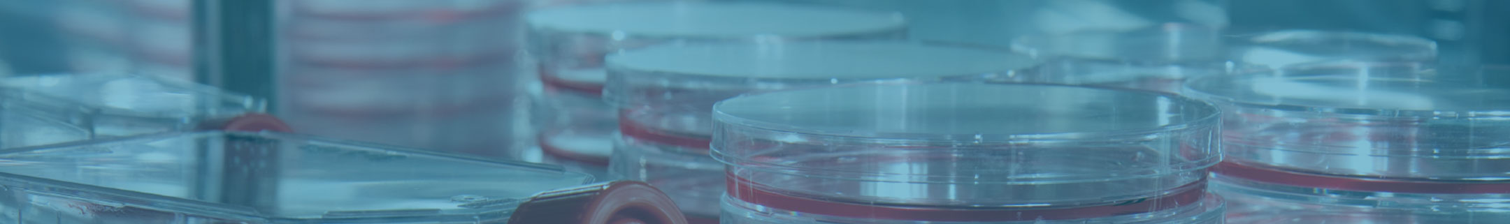 Tissue Culture Dishes