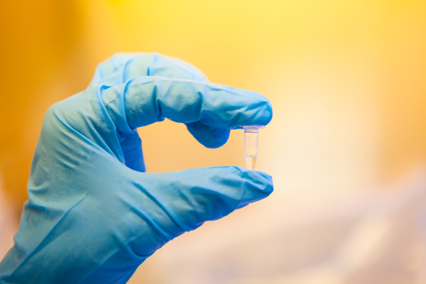 Exosome Isolation & Purification