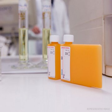 Fructosamine Liquid