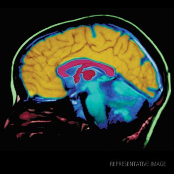 Human/Rat Beta Amyloid&#x