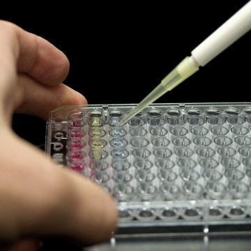 CD9-Capture Human Exosome 