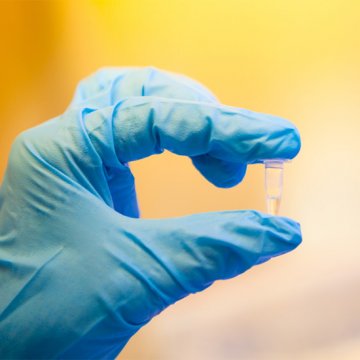 Anti-Phospho Histone H3 &