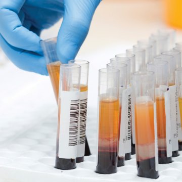 Protein Calibrator Low