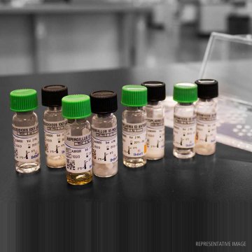 Paracoccidioides ID Control&#x