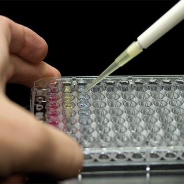 Prostate Specific Antigen 