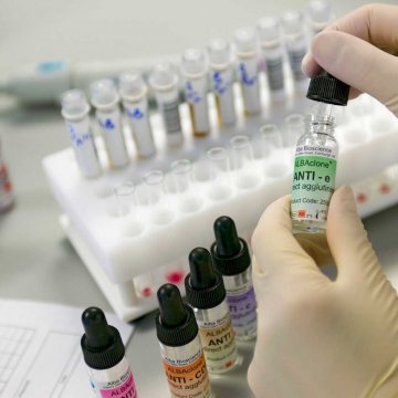 Anti-P1 Monoclonal