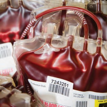 Reagent Control for Anti-